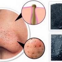 Маска для лица от черных точек в домашних условиях – рецепты