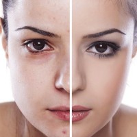 Неровная кожа лица: причины и способы решения проблемы